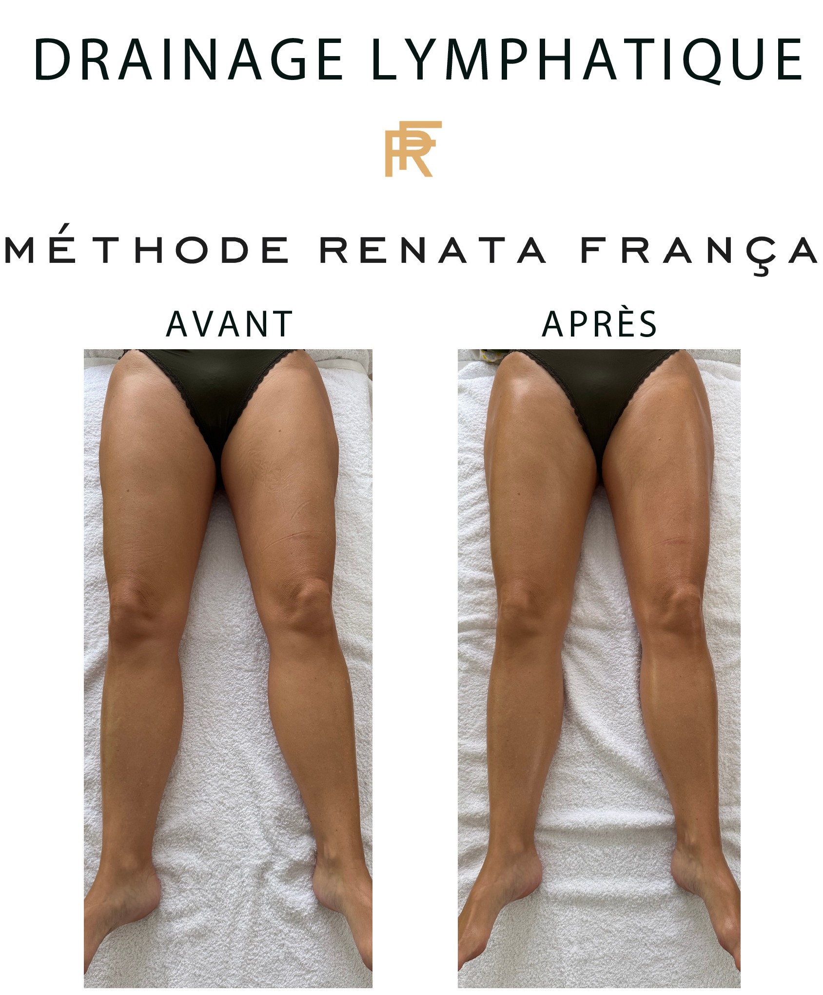 Drainage lymphatique - AVAP